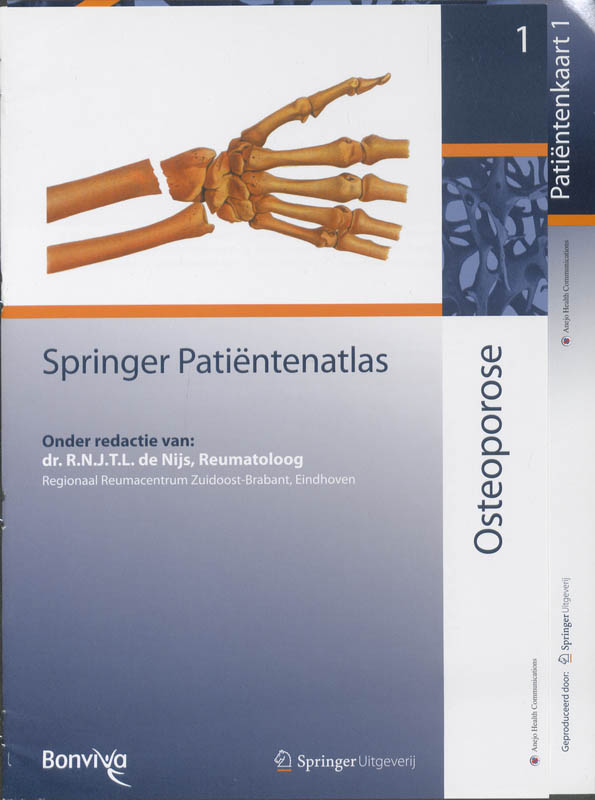 Omslag van Osteoporose
