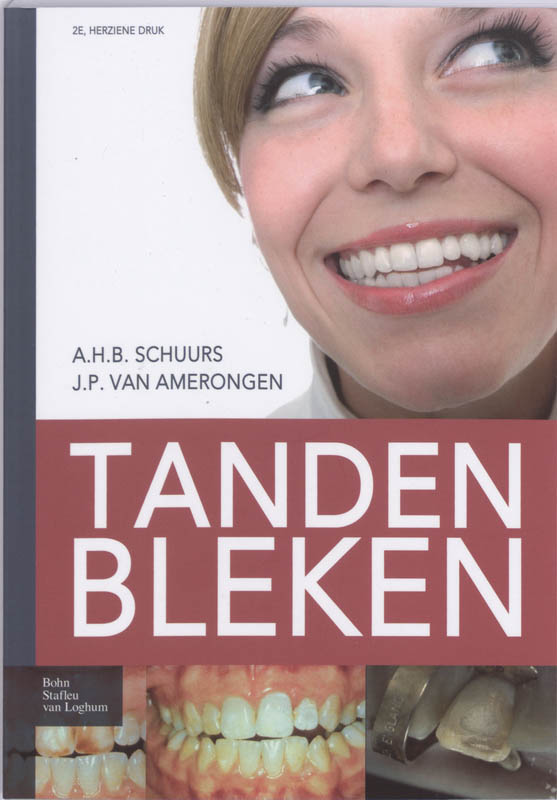 Omslag van Tanden bleken