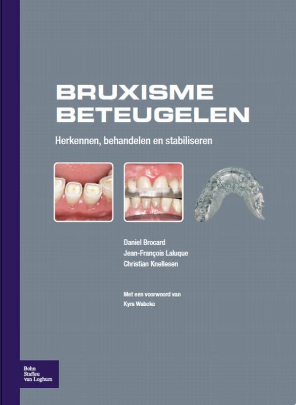 Omslag van Bruxisme beteugelen