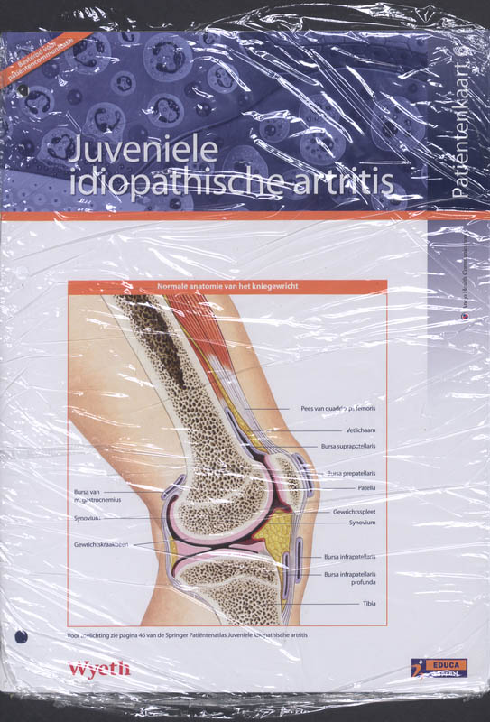 Omslag van Springer Patiëntenatlas Juveniele Idiopathische Artritis