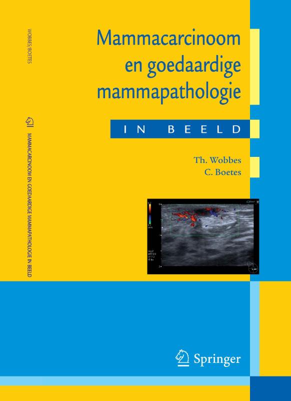 Omslag van Mammacarcinoom en goedaardige mammapathologie in beeld