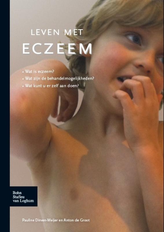 Omslag van Leven met eczeem