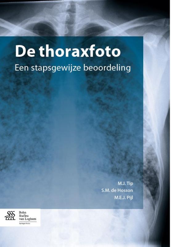 Omslag van De thoraxfoto