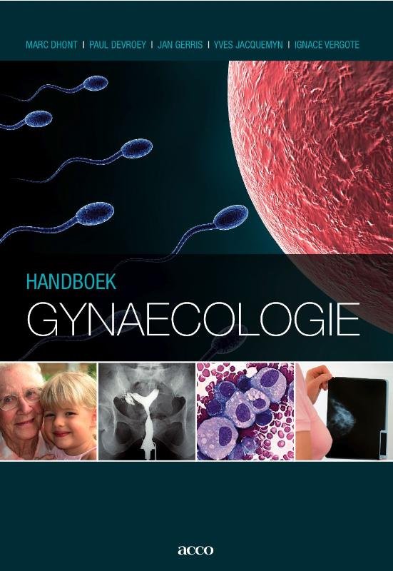Omslag van Handboek Gynaecologie