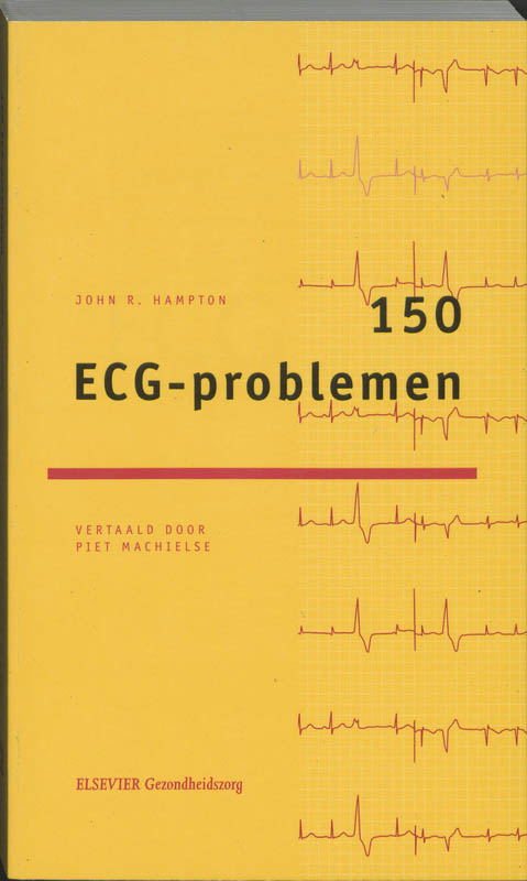 Omslag van 150 ECG-problemen