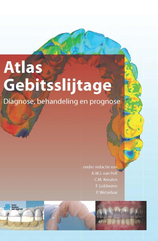 Omslag van Atlas gebitsslijtage