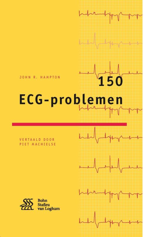 Omslag van 150 ECG-problemen