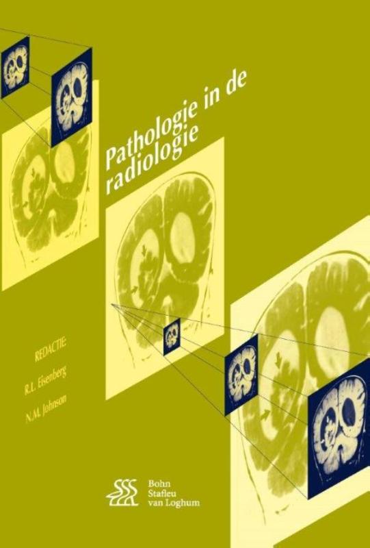 Omslag van Pathologie in de radiologie