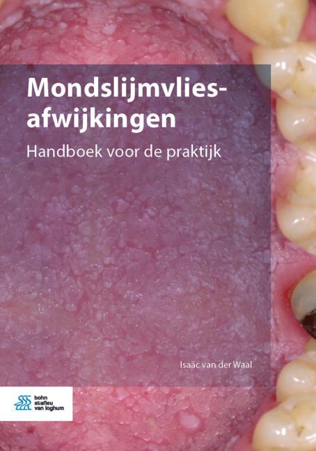 Omslag van Mondslijmvliesafwijkingen