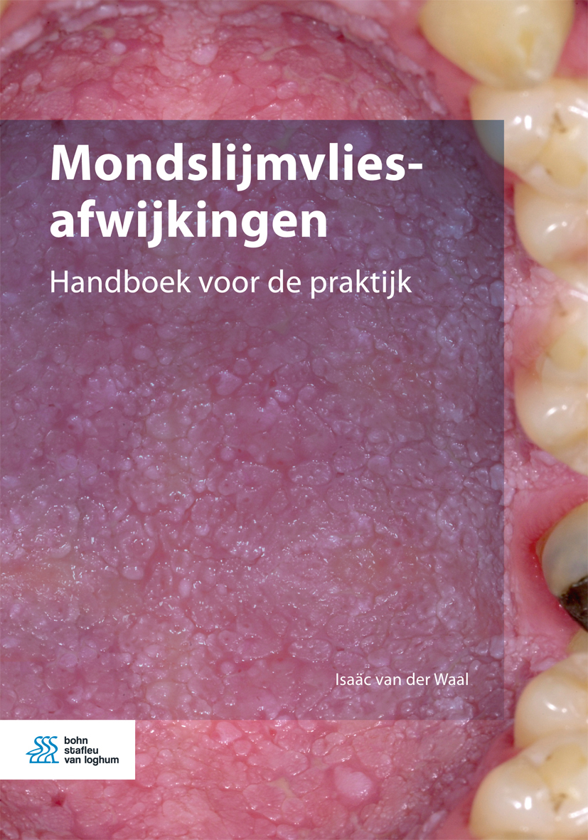 Omslag van Mondslijmvliesafwijkingen