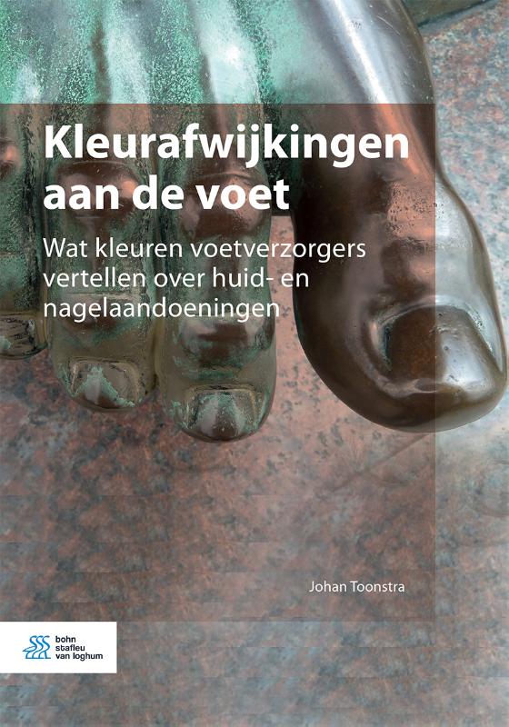 Omslag van Kleurafwijkingen aan de voet