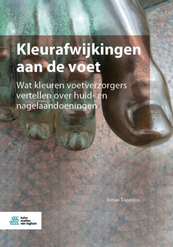 Omslag van Kleurafwijkingen aan de voet