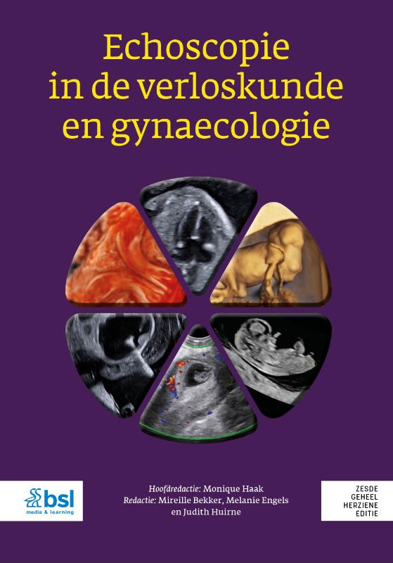 Omslag van Echoscopie in de verloskunde en gynaecologie