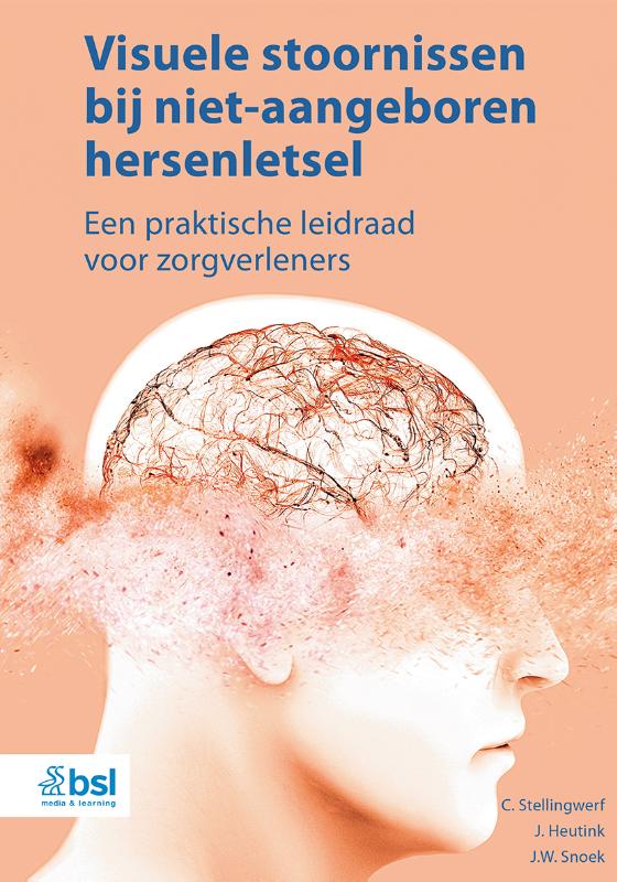 Omslag van Visuele stoornissen bij niet-aangeboren hersenletsel