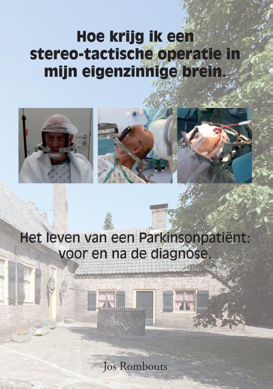 Omslag van Hoe krijg ik een stereo-tactische operatie in mijn eigenzinnige brein.