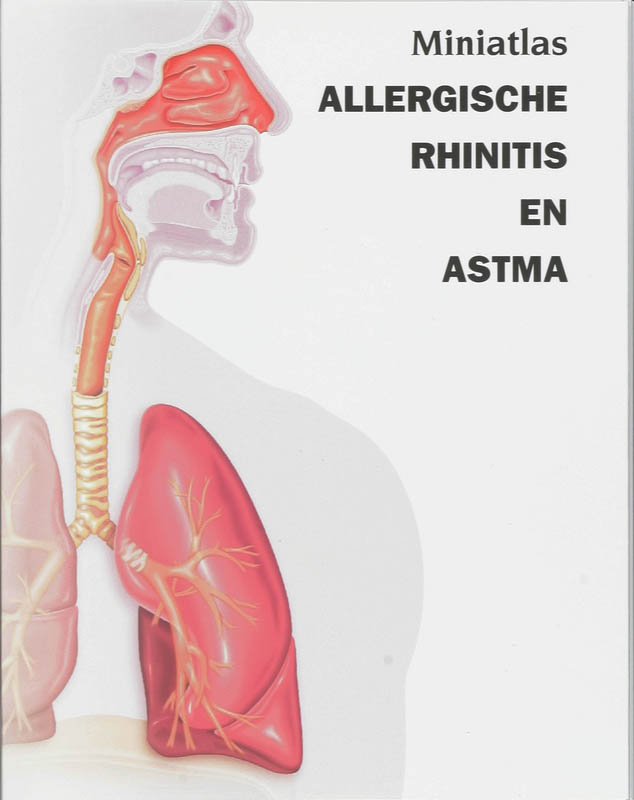 Omslag van Allergische Rhinitis en Astma