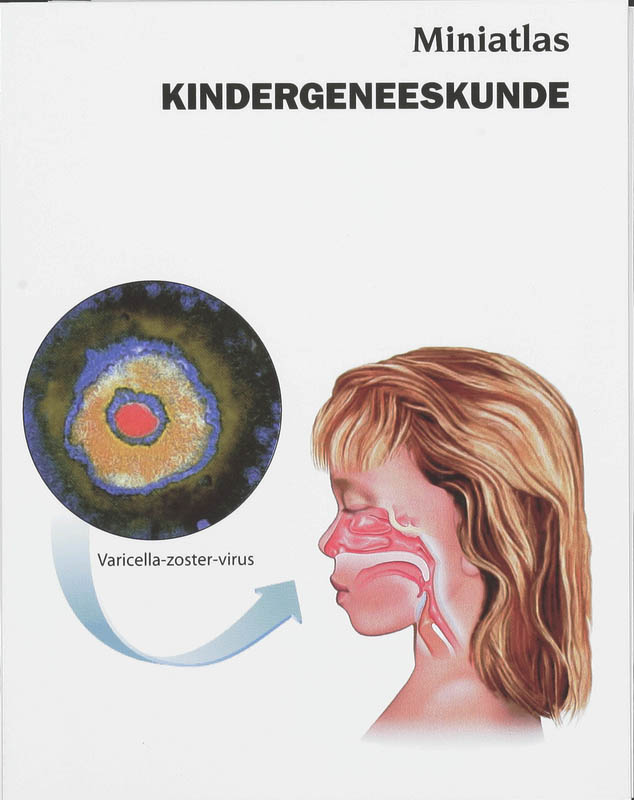 Omslag van Miniatlas Kindergeneeskunde