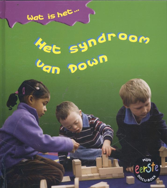 Omslag van Het syndroom van Down