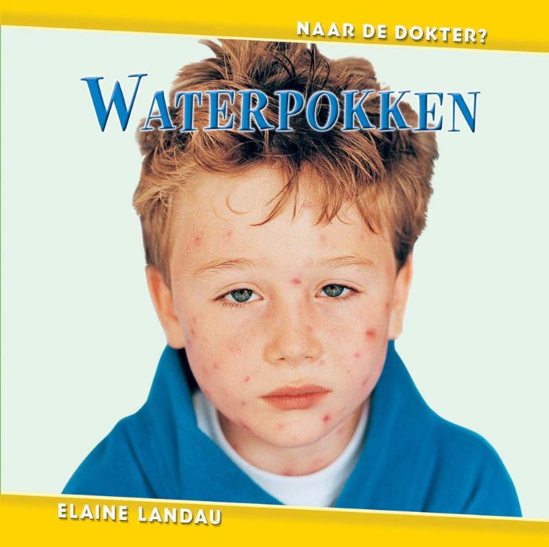 Omslag van Waterpokken