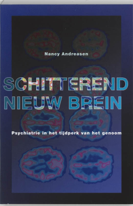 Omslag van Schitterend nieuw brein