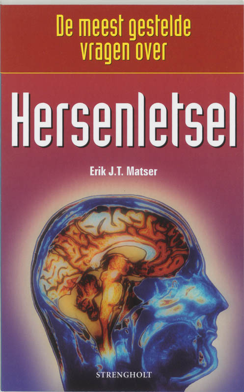 Omslag van De meest gestelde vragen over hersenletsel