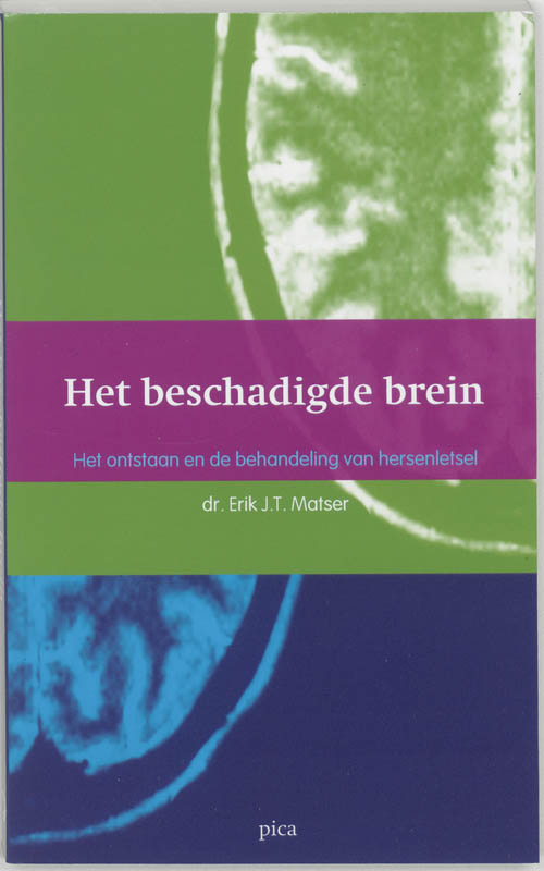 Omslag van Het beschadigde brein