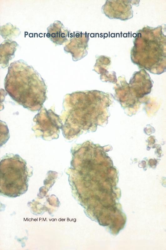 Omslag van Pancreatic islet transplantation