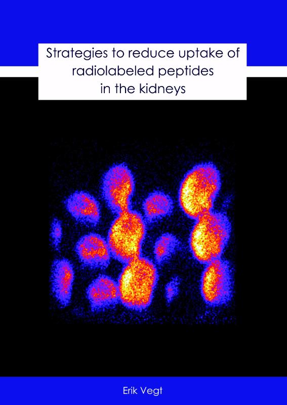 Omslag van Strategies to reduce uptake of radiolabeled peptides in the kidneys