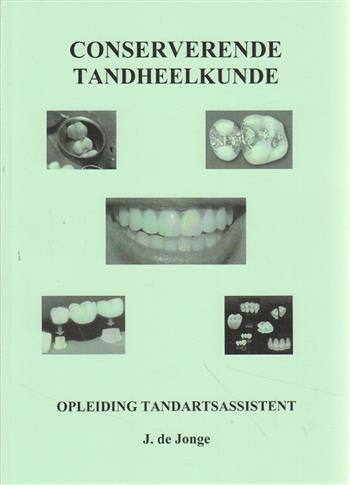 Omslag van Conserverende Tandheelkunde