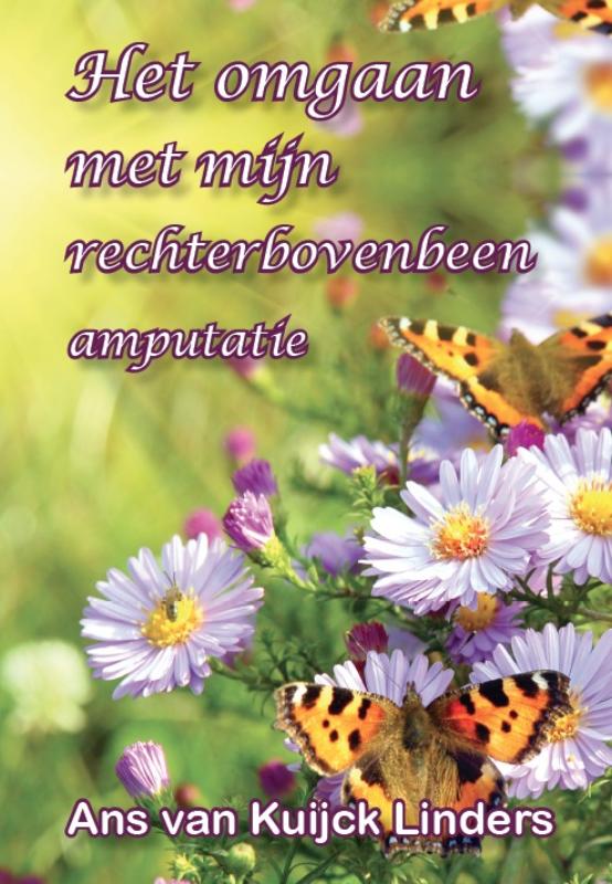 Omslag van het omgaan met mijn rechter bovenbeen amputatie