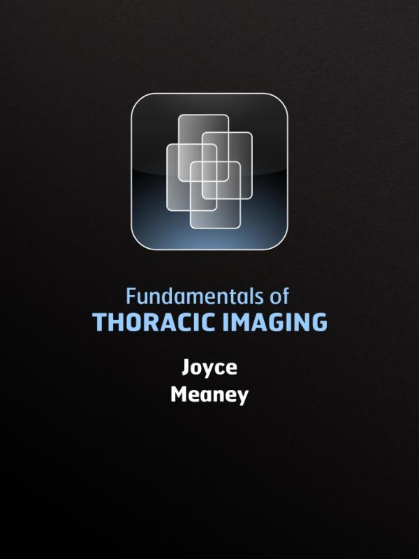 Omslag van Fundamentals of thoracic imaging
