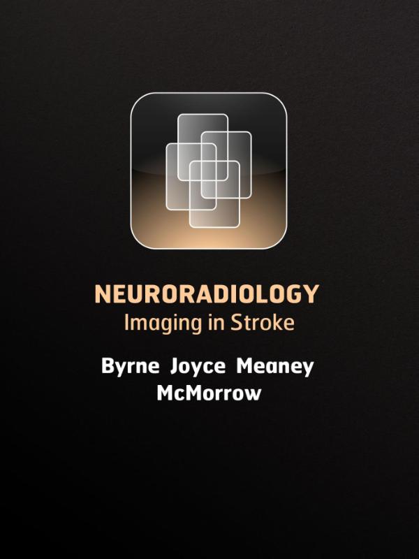 Omslag van Imaging in stroke