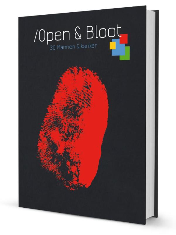 Omslag van Open & bloot