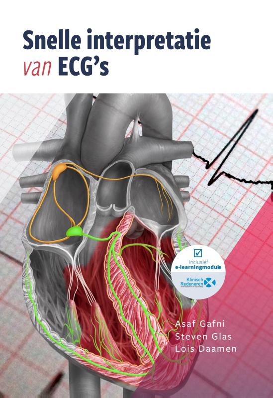 Omslag van Snelle interpretatie van ECG's