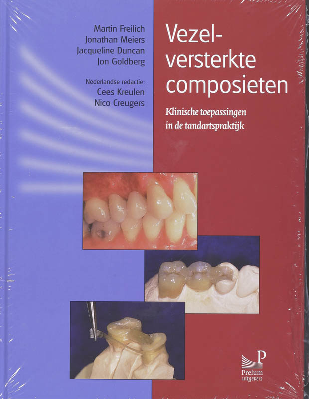 Omslag van Vezelversterkte composieten