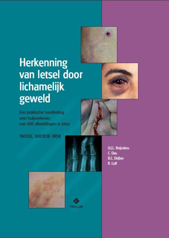 Omslag van Herkenning van letsel door lichamelijk geweld