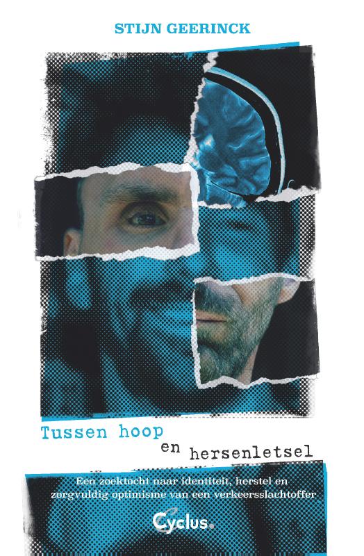 Omslag van Tussen hoop en hersenletsel