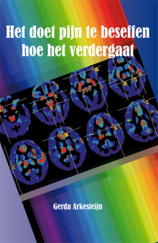 Omslag van Het doet pijn te beseffen hoe het verdergaat