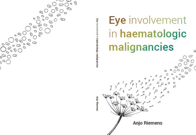 Omslag van Eye involvement in haematological malignancies