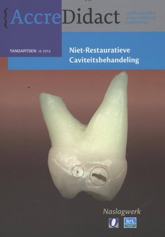 Omslag van Niet-restauratieve caviteitsbehandeling