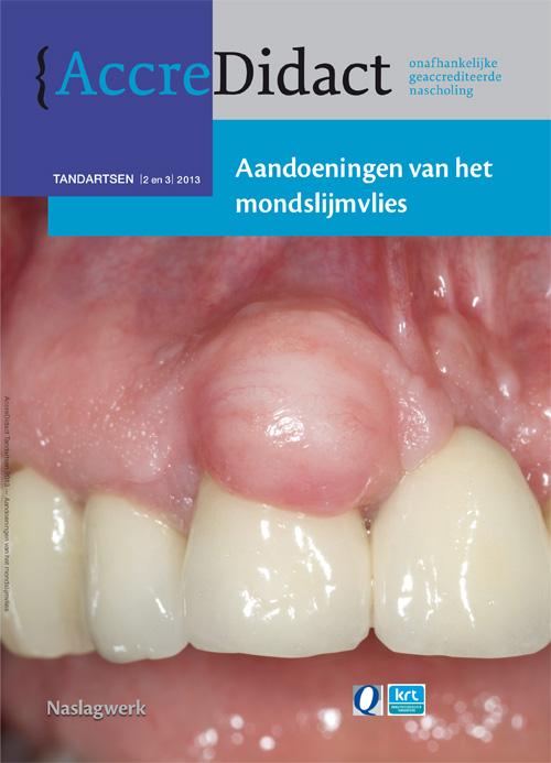 Omslag van Aandoeningen van het mondslijmvlies