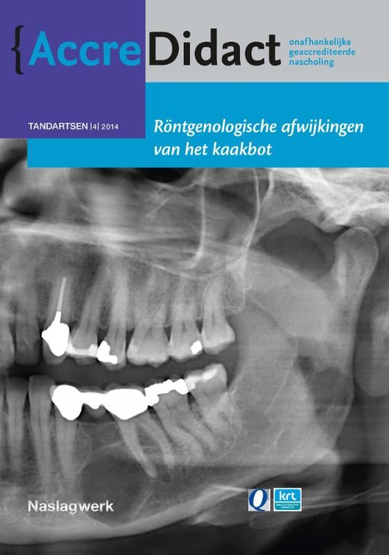 Omslag van Rontgenologische afwijkingen van het kaakbot