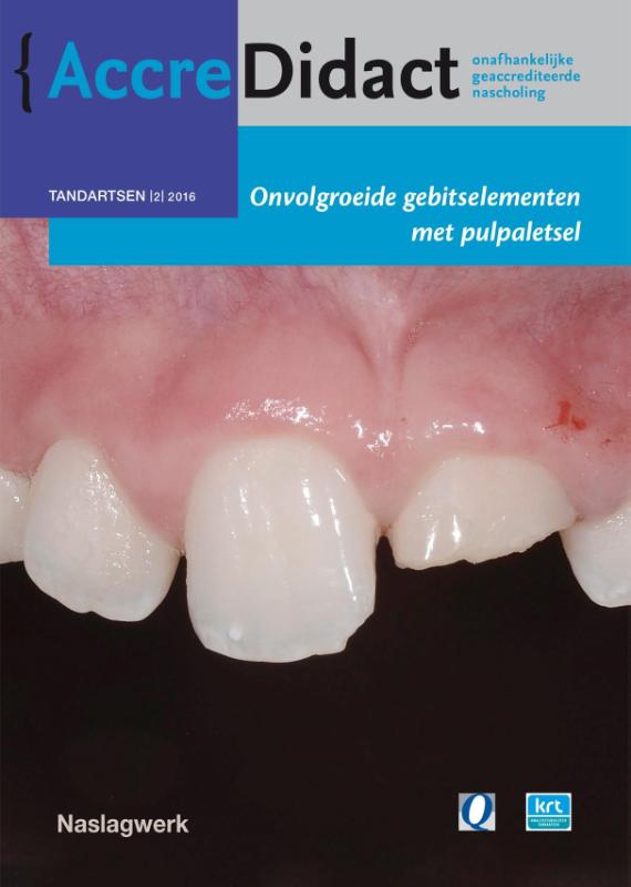 Omslag van Onvolgroeide gebitselementen met pulpaletsel