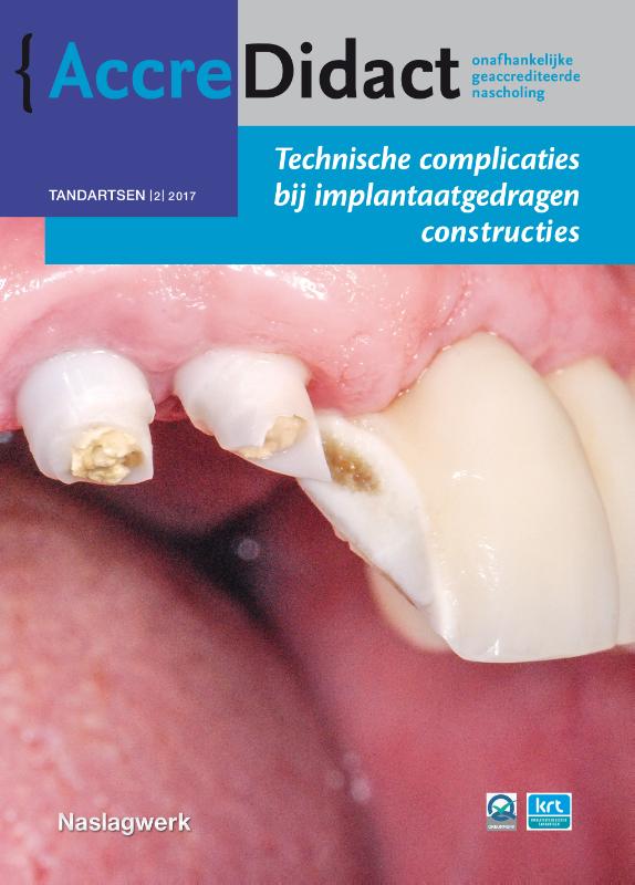 Omslag van Technische complicaties bij implantaatgedragen constructies