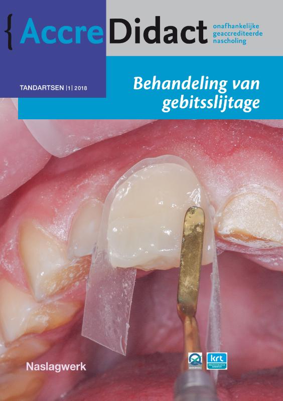 Omslag van Behandeling van gebitsslijtage