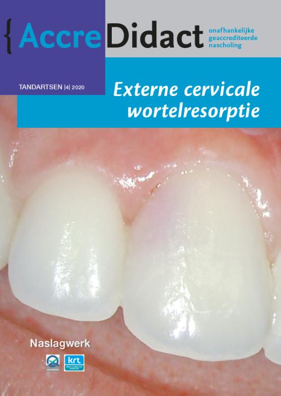 Omslag van Externe cervicale wortelresorptie