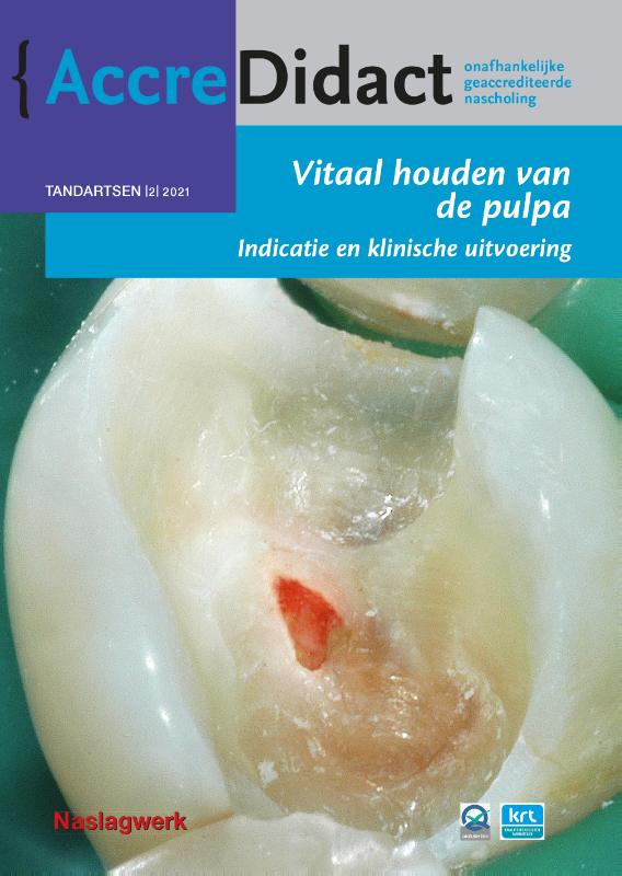 Omslag van Vitaal houden van de pulpa