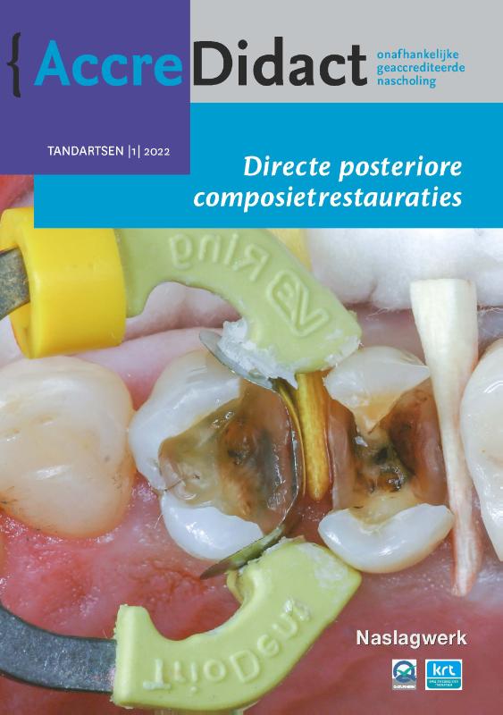 Omslag van Directe posteriore composietrestauraties