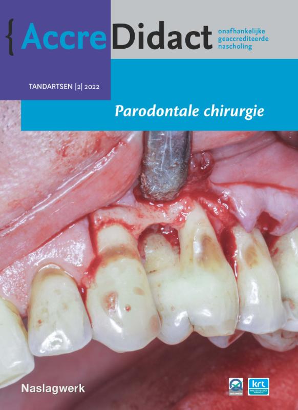 Omslag van Parodontale chirurgie