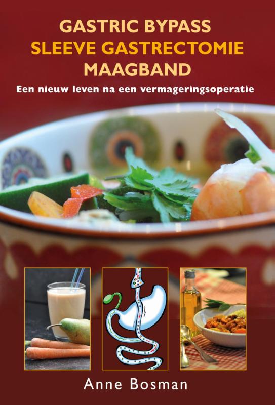 Omslag van Gastric bypass - Sleeve gastrectomie - maagband